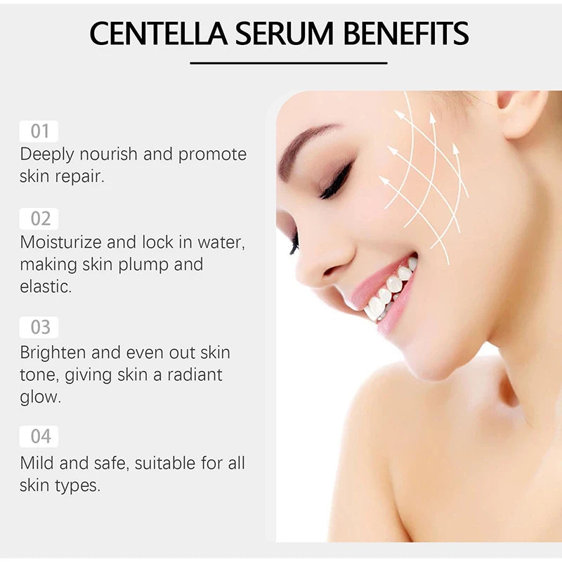Centella Asiatica Microneedle Essence Plant Extract Moisturizing Essence Refined Smooth Skin Nourishing Revitaliz Daily Skincare